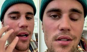 Justin Bieber Reveals Scary Battle With Virus